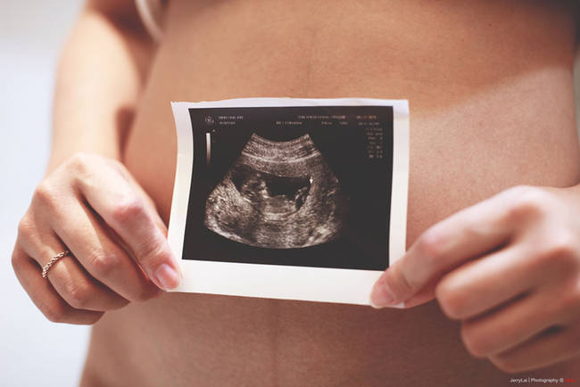 Sangat mungkin untuk hamil sepanjang tahun. Kehamilan terlama dalam catatan dilaporkan menjadi 375 hari.