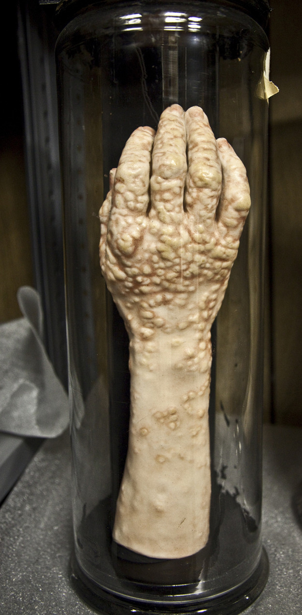 3.) Mutter Museum (Pennsylvania): The Mutter Museum adalah lembaga yang mengkhususkan diri pada kelainan medis. Ada organ, tulang, kaki, dan patung yang membuat Anda kedinginan. Keunikan medis, spesimen anatomi dan patologis, model lilin, dan peralatan medis antik terkenal di dunia.